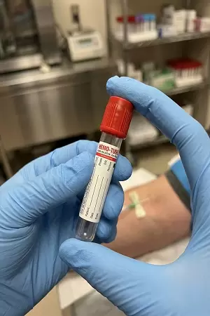 Non Vacuum Blood Collection Tube With Clot Activator Red Cap 4ml Sterile Serum Tubes Pack Of 100 For Lab Diagnostic Use